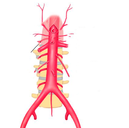 нормальная аорта и ее ветви